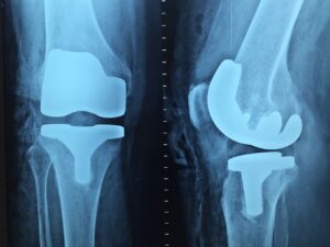 accertamenti di ortopedia a Monteveglio